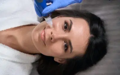 What is Microneedling?
