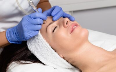 Moxi vs. Microneedling: Which Resurfacing is Right for You?